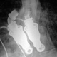 Illustration for article titled Life Without a Pulse Is Possible